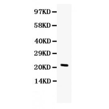 CSF3 / G-CSF Antibody (aa47-208)