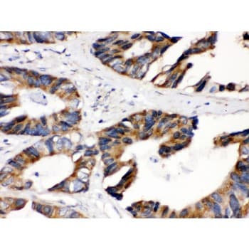 Polyclonal Rabbit anti-Human DLD / Diaphorase / E3 Antibody (aa300-509, IHC, WB)