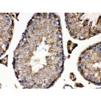 Polyclonal Rabbit anti-Human IDH1 / IDH Antibody (aa381-413, IHC, WB)