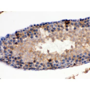 Polyclonal Rabbit anti-Human IDH1 / IDH Antibody (aa381-413, IHC, WB)