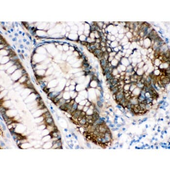 Polyclonal Rabbit anti-Human IDH1 / IDH Antibody (aa381-413, IHC, WB)