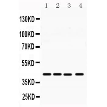 Polyclonal Rabbit anti-Human MICA Antibody (aa304-334, WB)