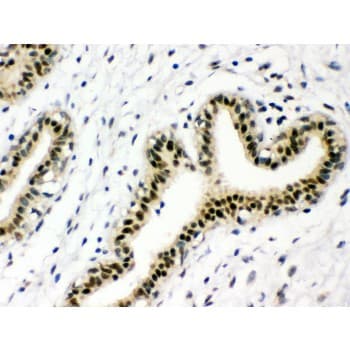 Polyclonal Rabbit anti-Human NBN / Nibrin Antibody (aa714-745, IHC, WB)