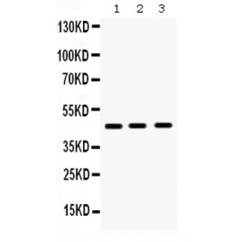 Polyclonal Rabbit anti-Human HHEX / HEX Antibody (aa146-180, WB)