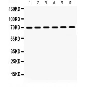 HSPA1A Antibody (aa559-596)