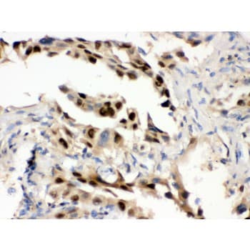 HSPA1A Antibody (aa559-596)