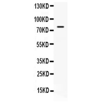 Polyclonal Rabbit anti-Human HSPA5 / GRP78 / BiP Antibody (aa592-624, IHC, WB)
