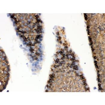 Polyclonal Rabbit anti-Human HSPA5 / GRP78 / BiP Antibody (aa592-624, IHC, WB)