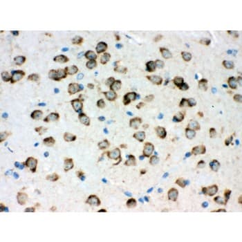 Polyclonal Rabbit anti-Human HSPA5 / GRP78 / BiP Antibody (aa592-624, IHC, WB)