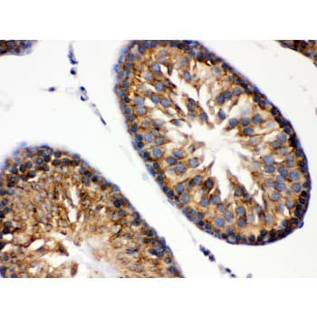Polyclonal Rabbit anti-Human HSPA5 / GRP78 / BiP Antibody (aa592-624, IHC, WB)