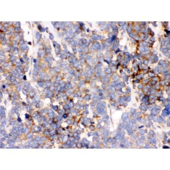 Polyclonal Rabbit anti-Human HSPA5 / GRP78 / BiP Antibody (aa592-624, IHC, WB)
