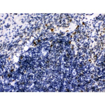 Polyclonal Rabbit anti-Human IKZF1 / IKAROS Antibody (aa428-459, IHC, WB)