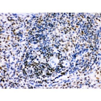 Polyclonal Rabbit anti-Human IKZF1 / IKAROS Antibody (aa428-459, IHC, WB)