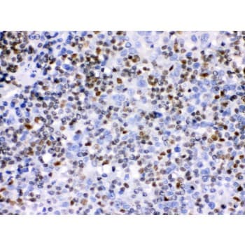 Polyclonal Rabbit anti-Human IKZF1 / IKAROS Antibody (aa428-459, IHC, WB)