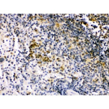 Polyclonal Rabbit anti-Human IRF5 Antibody (aa442-472, IHC, WB)
