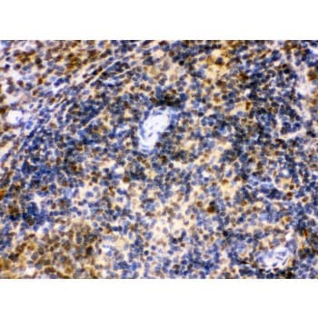 Polyclonal Rabbit anti-Human IRF5 Antibody (aa442-472, IHC, WB)