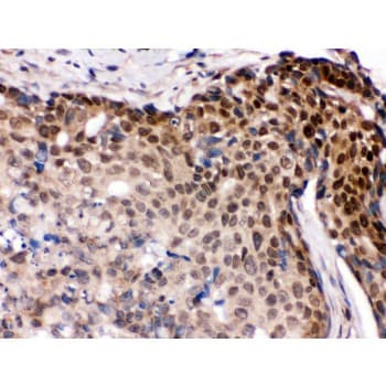 Polyclonal Rabbit anti-Human IRF5 Antibody (aa442-472, IHC, WB)