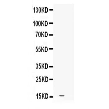 Polyclonal Rabbit anti-Mouse Leptin Antibody (aa74-109, WB)
