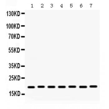 LYZ / Lysozyme Antibody (aa106-141)
