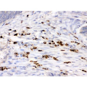 LYZ / Lysozyme Antibody (aa106-141)