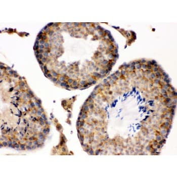 S100A6 / Calcyclin Antibody (aa1-90)