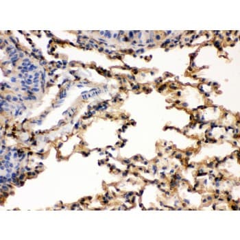 S100A6 / Calcyclin Antibody (aa1-90)
