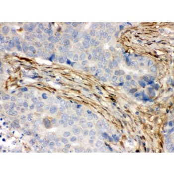 S100A6 / Calcyclin Antibody (aa1-90)