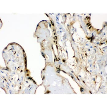 S100A6 / Calcyclin Antibody (aa1-90)