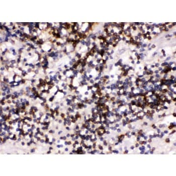 Polyclonal Rabbit anti-Human CD22 Antibody (aa696-724, IHC, WB)