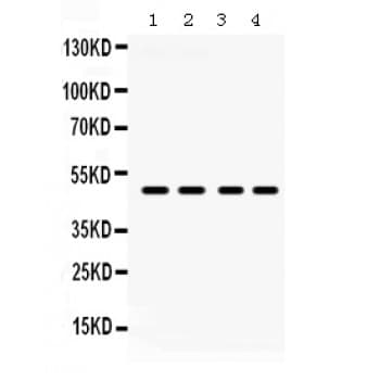 Polyclonal Rabbit anti-Human F2RL1 / PAR2 Antibody (aa349-383, WB)