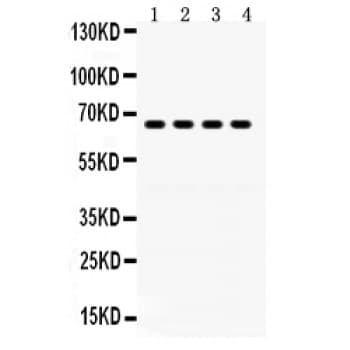 Polyclonal Rabbit anti-Human GRK6 Antibody (aa382-417, WB)
