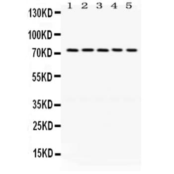 LIMK1 / LIMK Antibody (aa599-634)