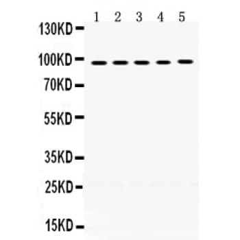 MCM8 Antibody (aa809-840)
