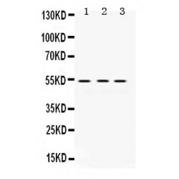 MMP1 Antibody (aa194-231)