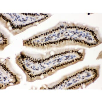 Polyclonal Rabbit anti-Human PRKAB2 / AMPK Beta 2 Antibody (aa56-89, IHC, WB)
