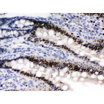 Polyclonal Rabbit anti-Human PRKAB2 / AMPK Beta 2 Antibody (aa56-89, IHC, WB)