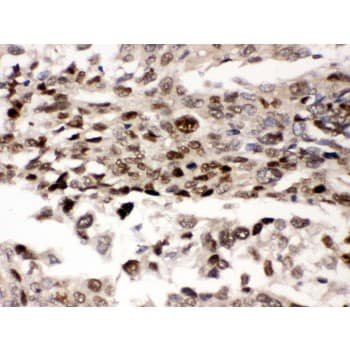 Polyclonal Rabbit anti-Human PRKAB2 / AMPK Beta 2 Antibody (aa56-89, IHC, WB)