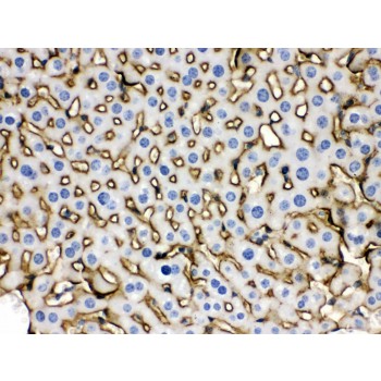 Polyclonal Rabbit anti-Mouse SLC10A1 / NTCP Antibody (aa296-336, IHC, WB)