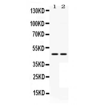 MAP2K7 / MEK7 Antibody (aa2-40)
