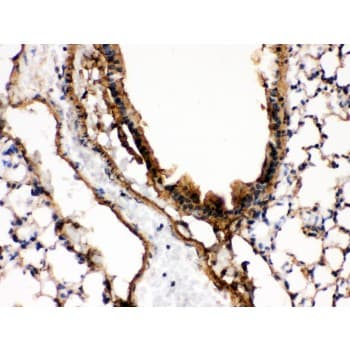 MAP2K7 / MEK7 Antibody (aa2-40)