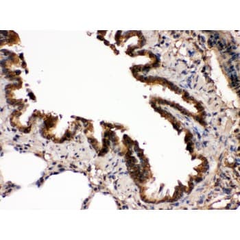 MAP2K7 / MEK7 Antibody (aa2-40)