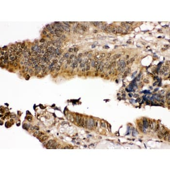 MAP2K7 / MEK7 Antibody (aa2-40)