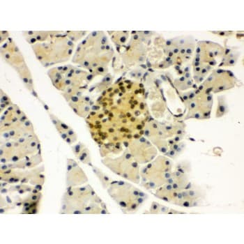 Polyclonal Rabbit anti-Human PAX6 Antibody (aa195-233, IHC, WB)