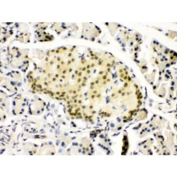 Polyclonal Rabbit anti-Human PAX6 Antibody (aa195-233, IHC, WB)