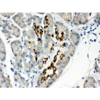 Polyclonal Rabbit anti-Human PAX6 Antibody (aa195-233, IHC, WB)