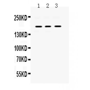PDGFRA / PDGFR Alpha Antibody (aa968-1002)