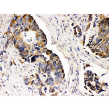PDGFRA / PDGFR Alpha Antibody (aa968-1002)
