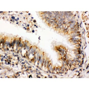 Polyclonal Rabbit anti-Human PDIA3 / ERp57 Antibody (aa471-505, IHC, WB)
