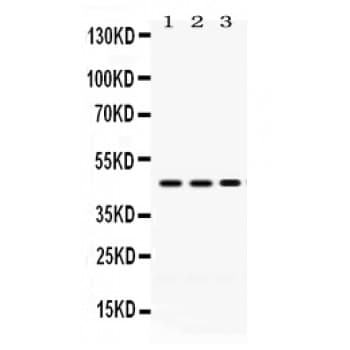 PDK4 Antibody (aa91-125)