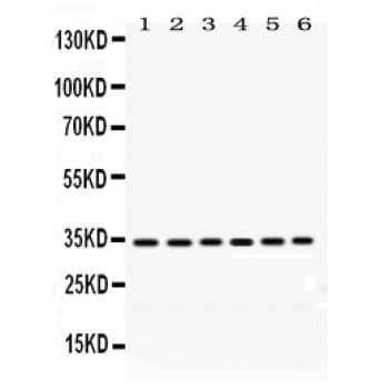 Polyclonal Rabbit anti-Human PPT1 / CLN1 Antibody (aa191-224, IHC, WB)
